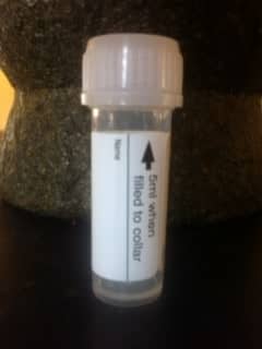 Adrenal Saliva Test Tube