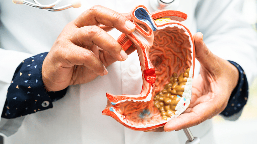 Gut conditions increasing LDL cholesterol