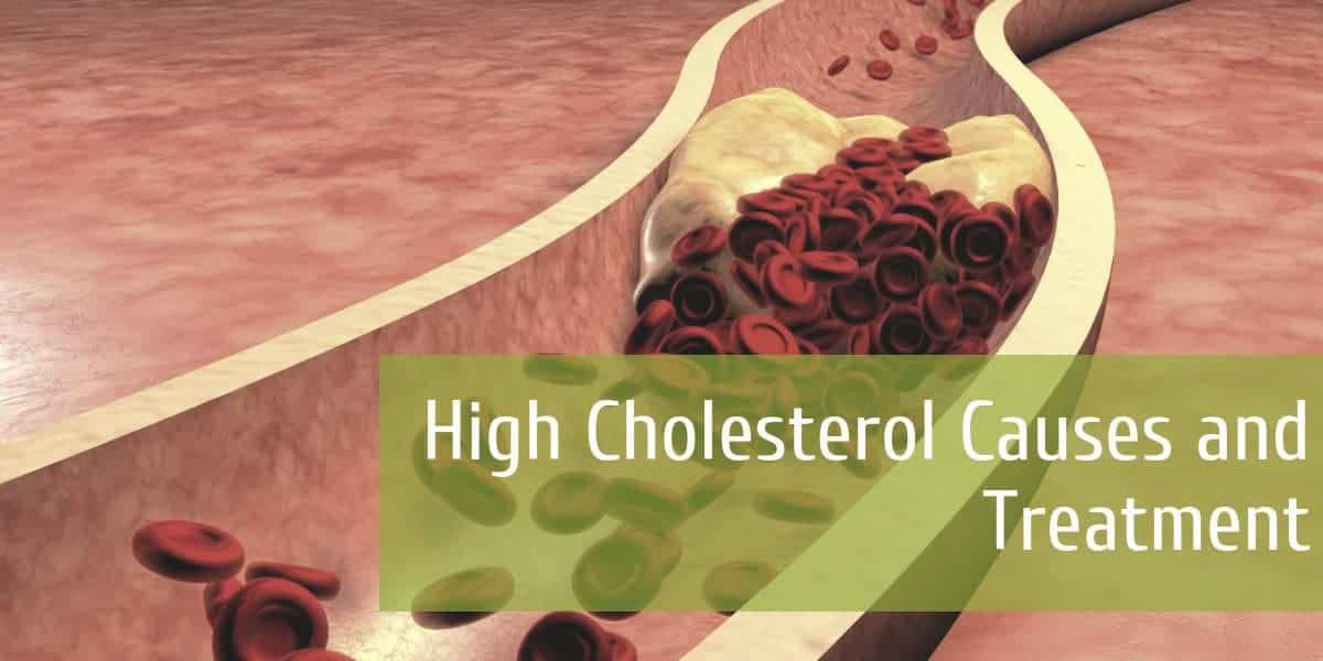 High Cholesterol Causes and Treatment