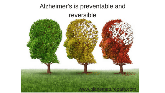 Alzheimer's is a slow decline