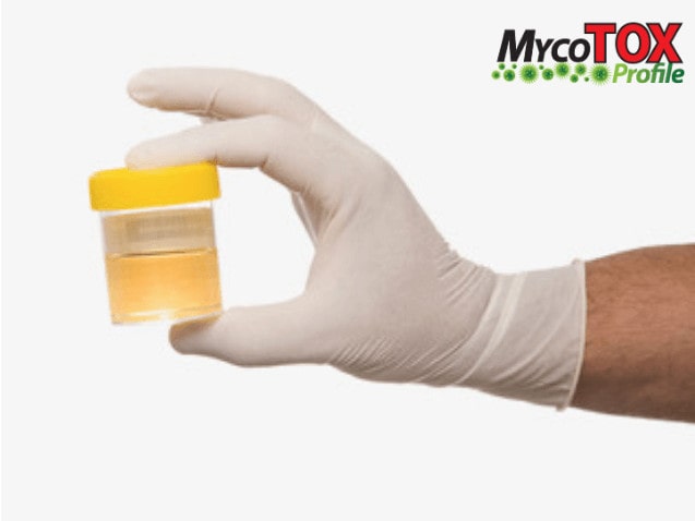GPL-MycoTox Profile 18 MycoTox