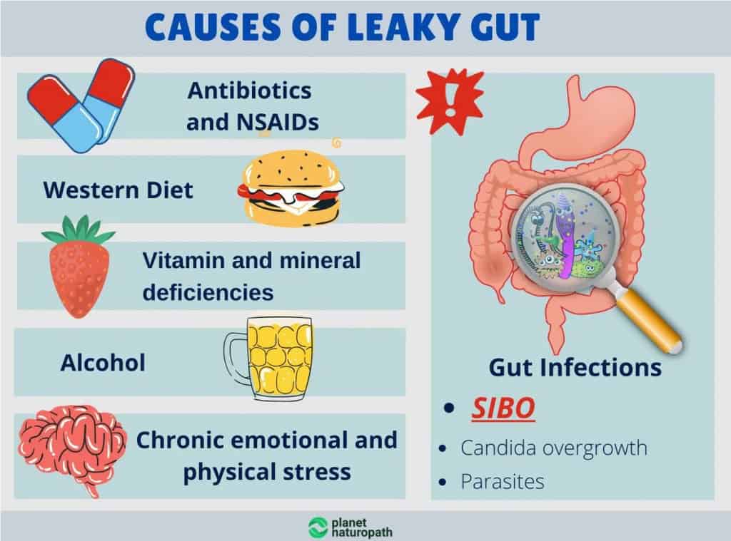 SIBO Guide (To Help You Eliminate IBS) 10 SIBO Guide (To Help You Eliminate IBS) 9