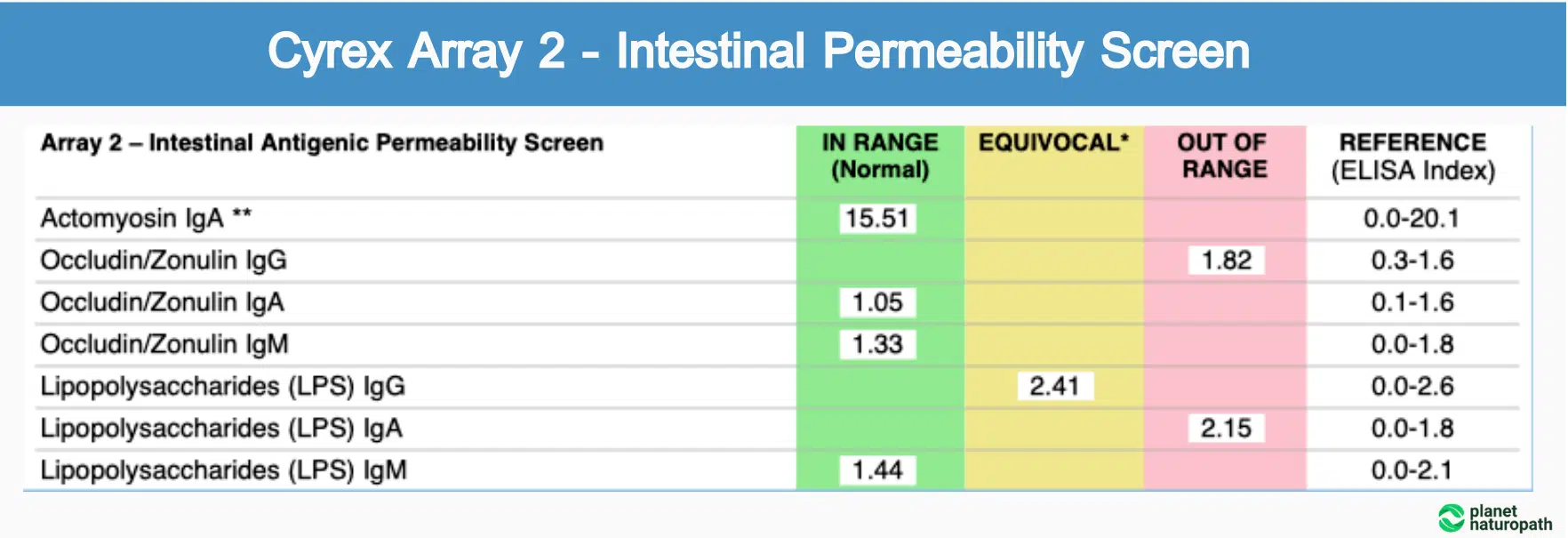 Cyrex Tests: 9 of the Most Popular Options 3 Cyrex Tests: 9 of the Most Popular Options 2