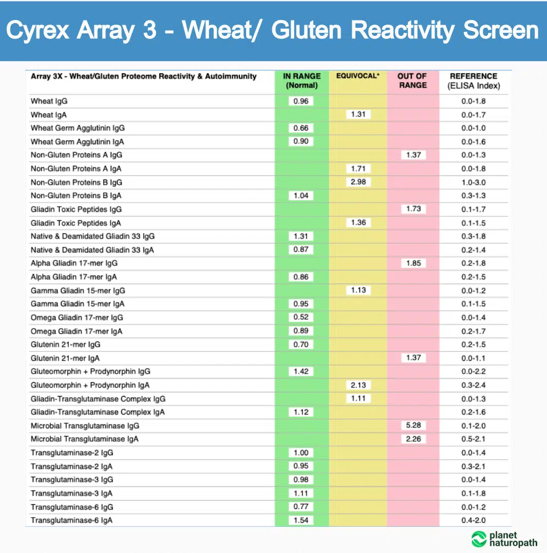 Cyrex Tests: 9 of the Most Popular Options 5 Cyrex Tests: 9 of the Most Popular Options 4
