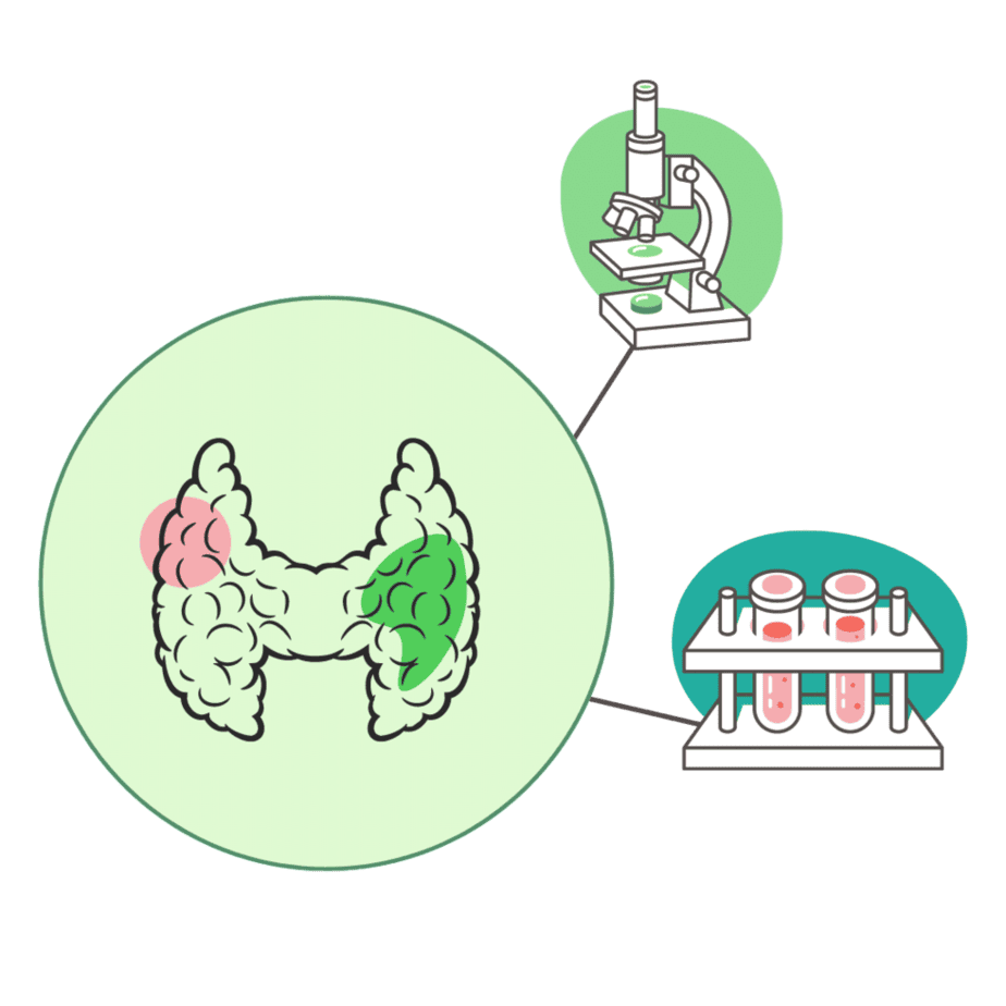 Complete Thyroid Test