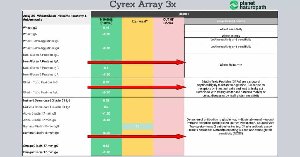 Cyrex array 3X test interpretation