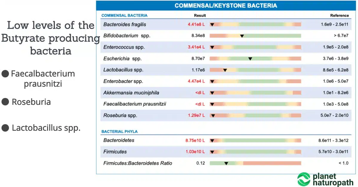 Butyrate Benefits: 10 Things You Need to Know 4 Butyrate Benefits: 10 Things You Need to Know 4