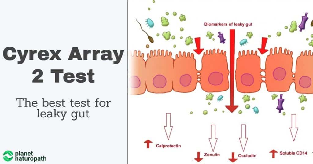 cyrex array 2 leaky gut test