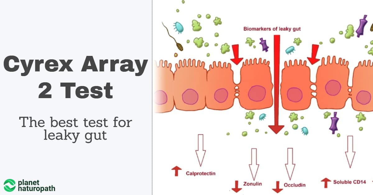 cyrex array 2 leaky gut test