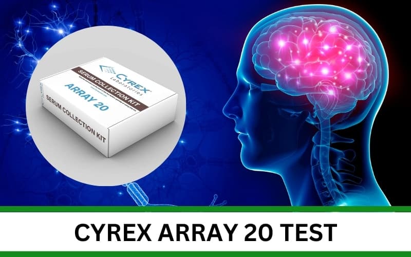 Cyrex Array 12 Test featured image