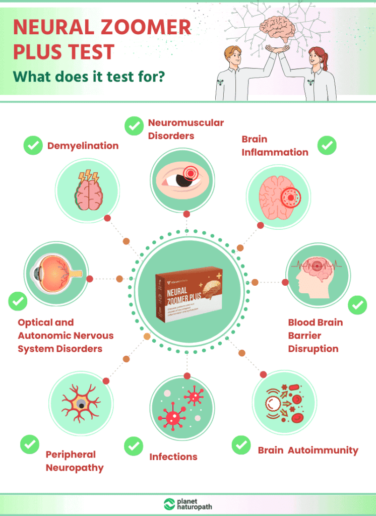 What does Neural Zoomer Plus Test measure