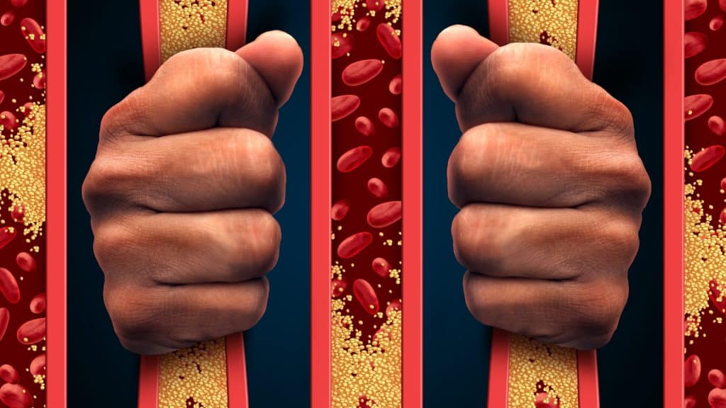 Causes High Cholesterol