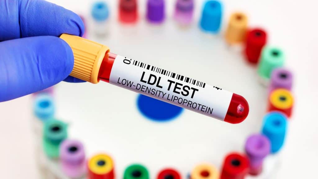 Low-Density Lipoprotein