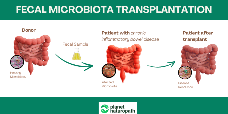Fecal Microbiota Transplantation
