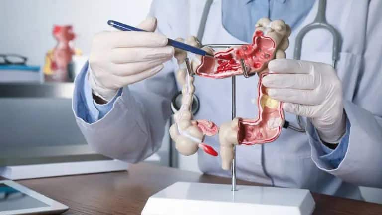 20 Unusual Facts About Gut Health 17