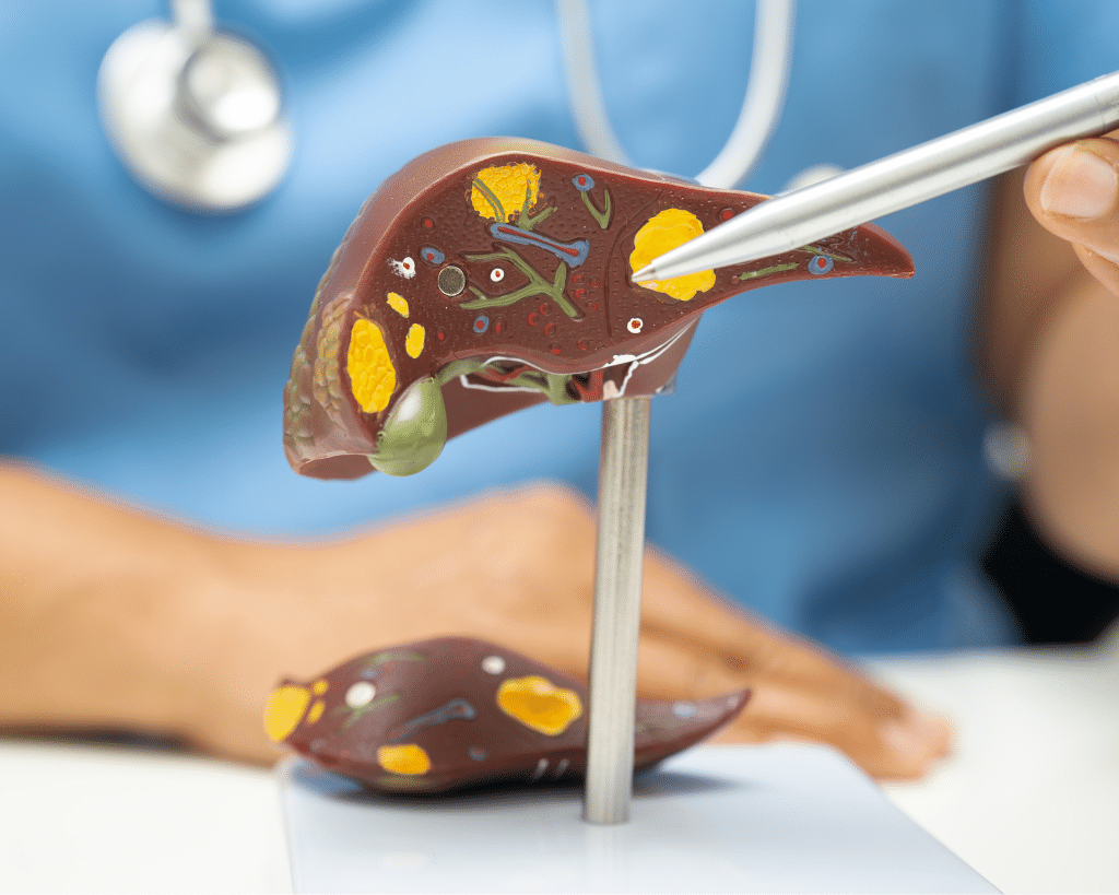 Detox Gut–Liver Support