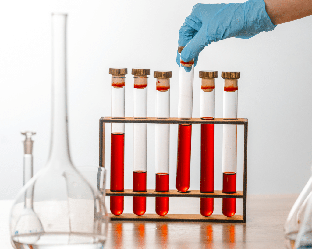 Inflammation & Gut Markers