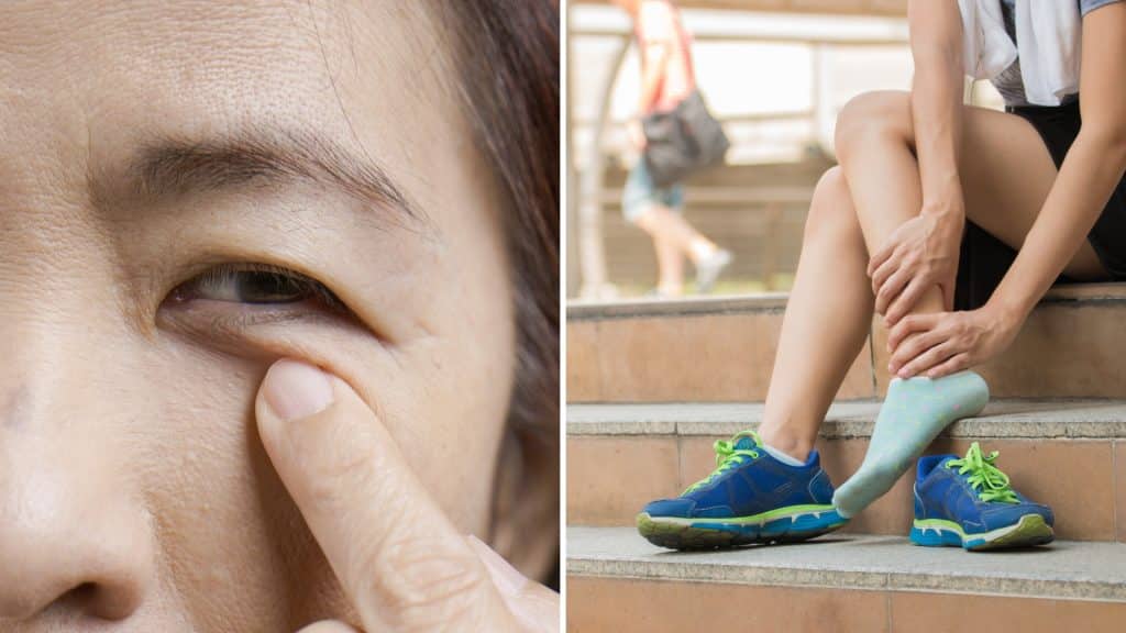 Person experiencing leg discomfort outdoors.